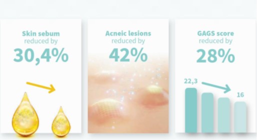 acne skincare treatment guide